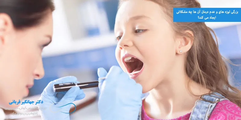 بزرگی لوزه های و عدم درمان آن ها چه مشکلاتی ایجاد می کند؟