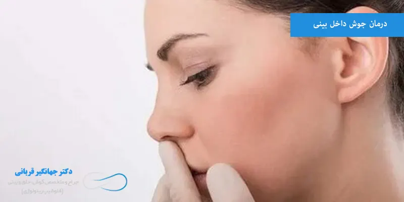 درمان جوش داخل بینی