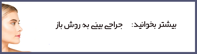 مراقبت های قبل از جراحی بینی